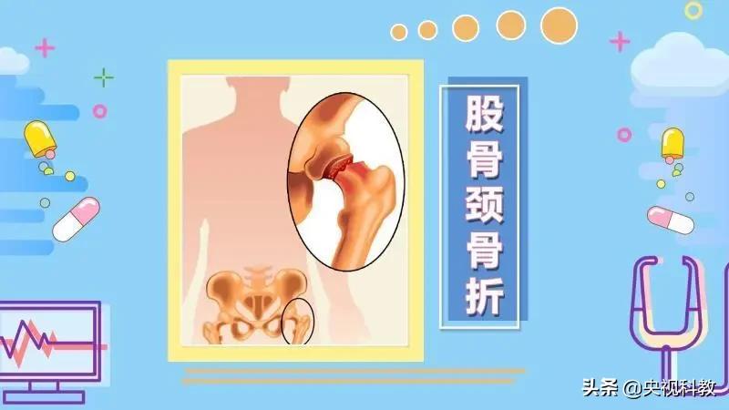 手腕扭伤一个月仍疼痛，原因、处理与预防